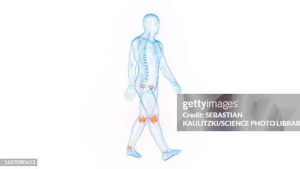 joint pain while walking, illustration - hips stock-grafiken, -clipart, -cartoons und -symbole