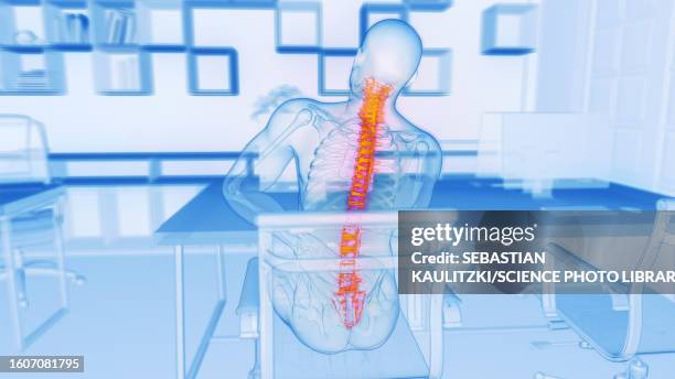 back pain at work, illustration - occupational health stock-grafiken, -clipart, -cartoons und -symbole