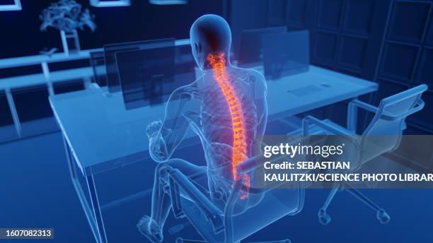 illustrazioni stock, clip art, cartoni animati e icone di tendenza di back pain at work, illustration - postura