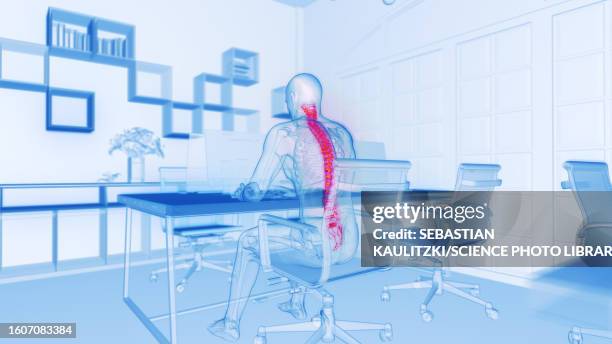 bildbanksillustrationer, clip art samt tecknat material och ikoner med back pain at work, illustration - occupational health