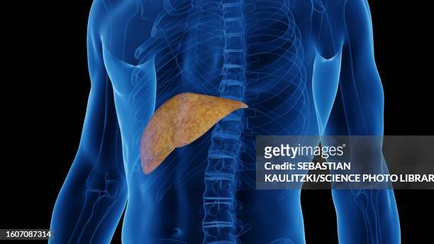Fatty Liver Photos and Premium High Res Pictures - Getty Images