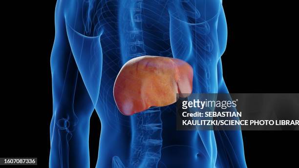 healthy liver turning into fatty liver, illustration - human liver stock illustrations