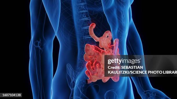 inflamed small intestine, illustration - celiac disease stock illustrations
