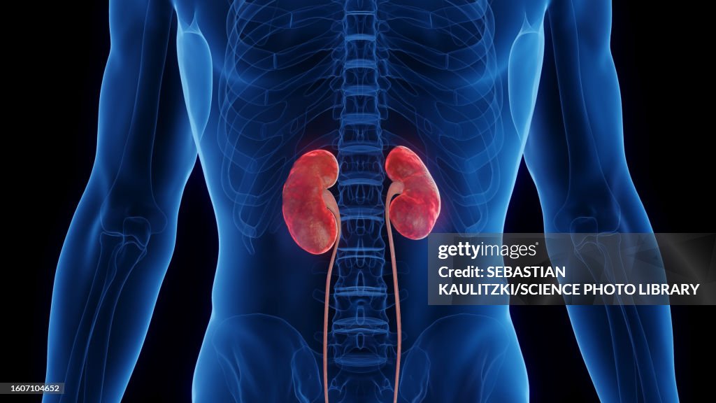 Inflamed kidneys, illustration