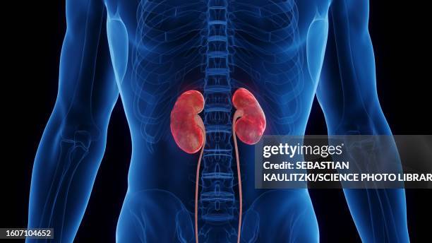 inflamed kidneys, illustration - human kidney illustrations stock illustrations