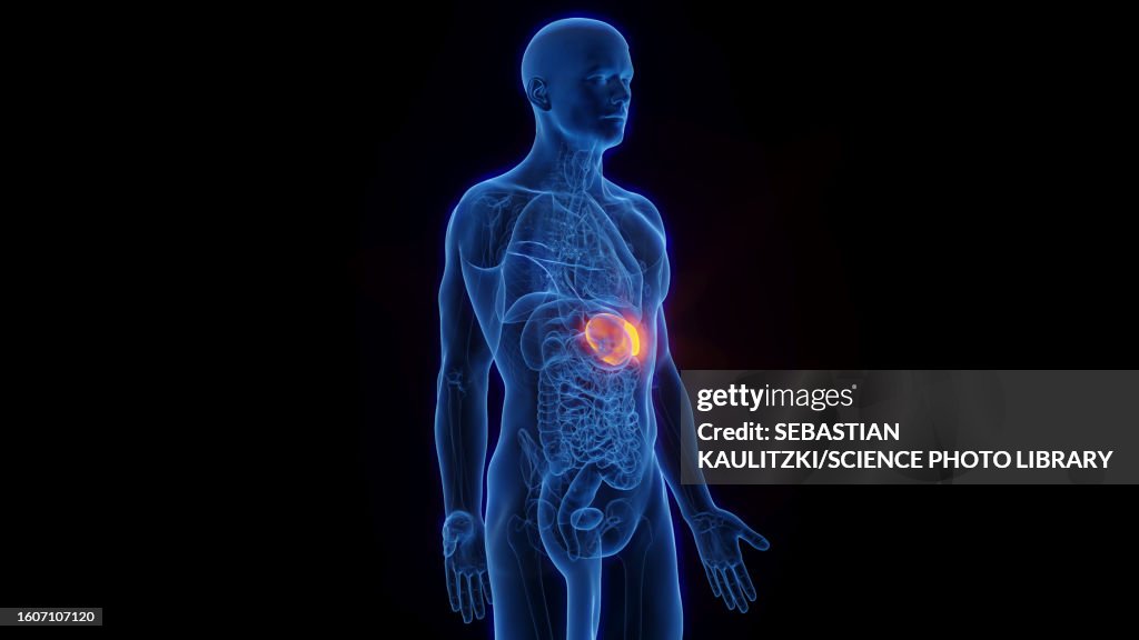 Spleen, illustration