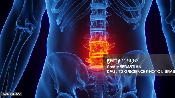 Lumbar Rfl 183 Lower Lumbar Stock Photos, High-Res Pictures, and Images - Getty Images