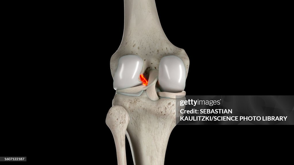 Anterior cruciate ligament, illustration