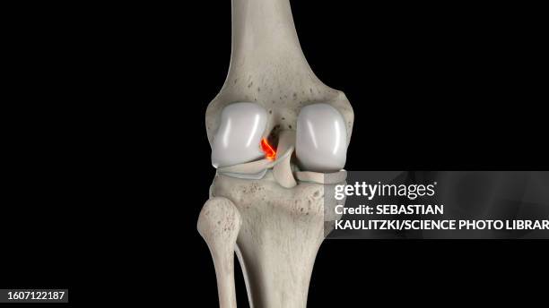 anterior cruciate ligament, illustration - anterior cruciate ligament stock illustrations