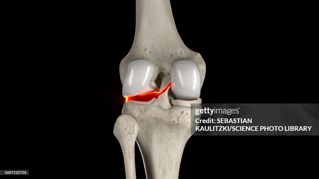 Lateral meniscus, illustration