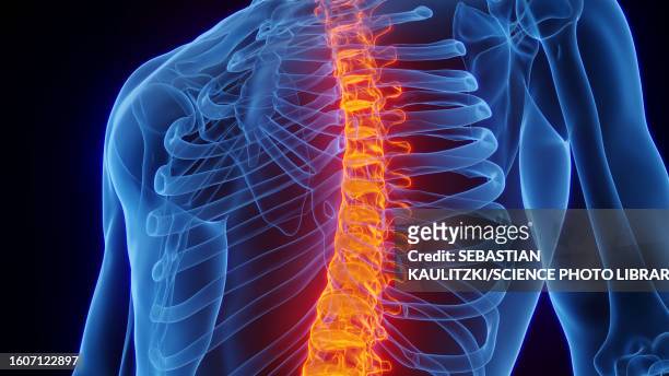 inflamed spine, illustration - human spine stock illustrations