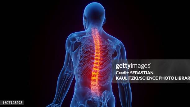 inflamed spine, illustration - human back anatomy stock illustrations