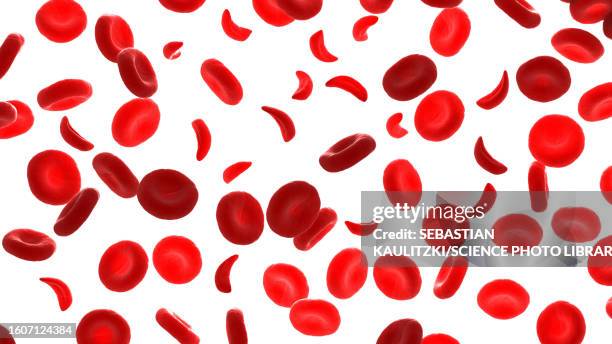 sickle cells, illustration - blood cell stock illustrations