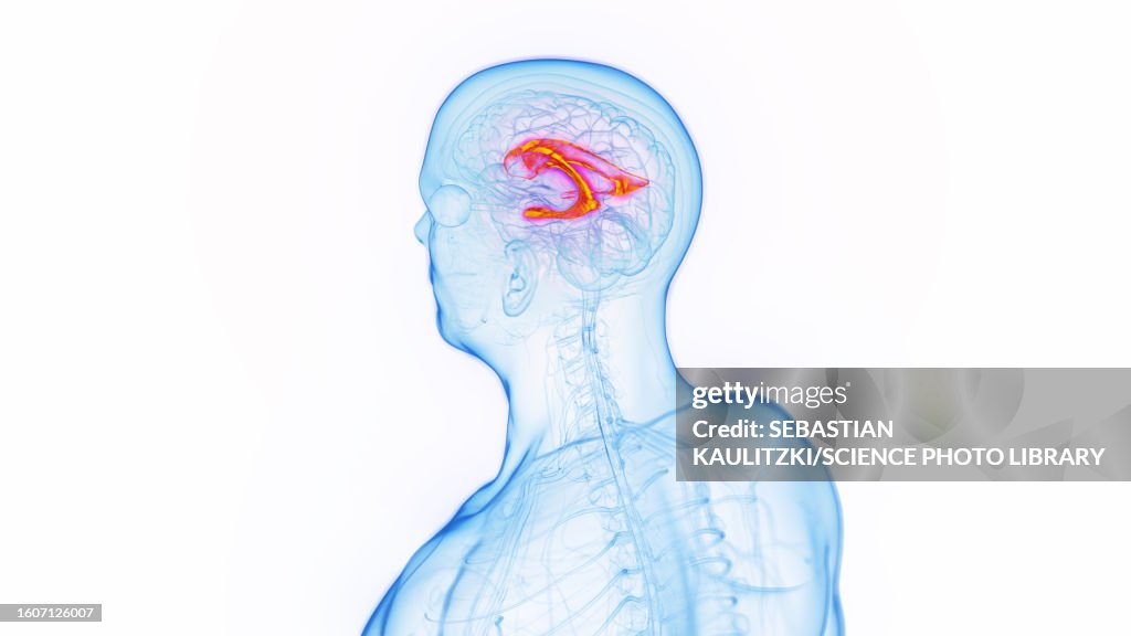 Lateral ventricle, illustration