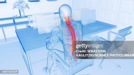 Back pain at work, illustration Back pain at work, illustration