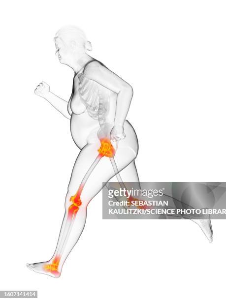 overweight woman running with painful joints, illustration - human build stock illustrations