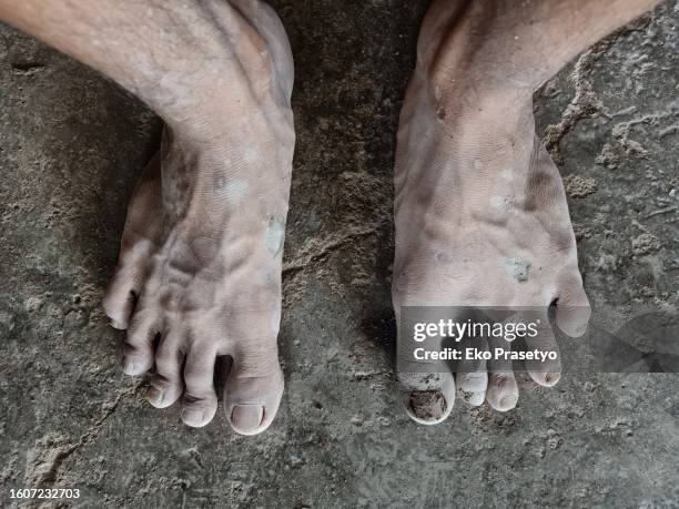 Feet Hard Skin Fotografías e imágenes de stock - Getty Images