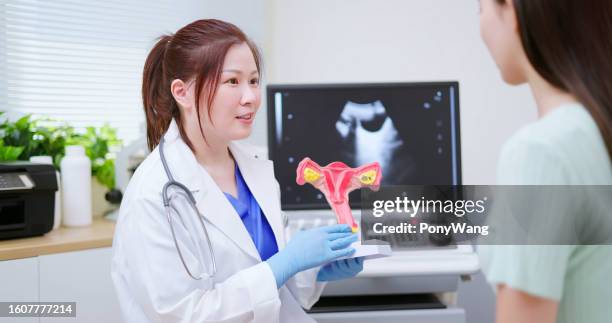 doctor explain uterus model - cérvix imagens e fotografias de stock