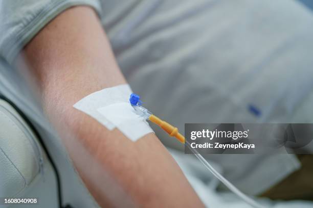 intravenöse infusion - blood veins stock-fotos und bilder
