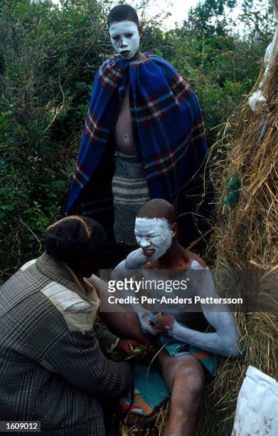 Xhosa boy who has been circumcised a day earlier grimaces with pain December 5, 2000 as a male nurse examines his wounds in Mdantsane outside East...