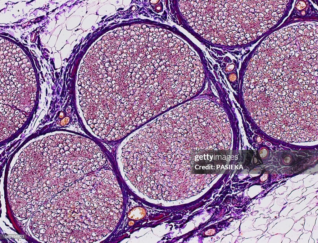 Nerve fibres, light micrograph