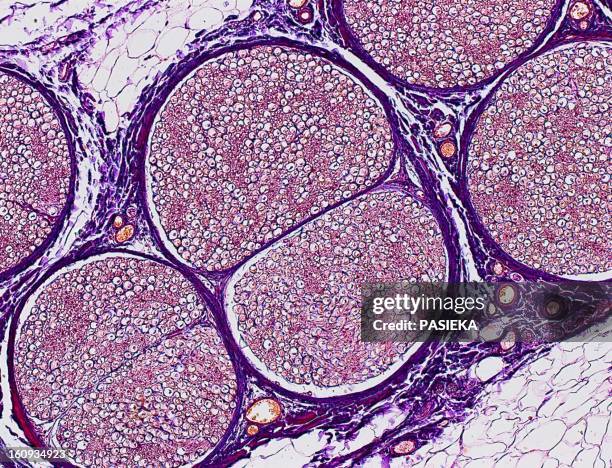 nerve fibres, light micrograph - nerve fiber stock pictures, royalty-free photos & images