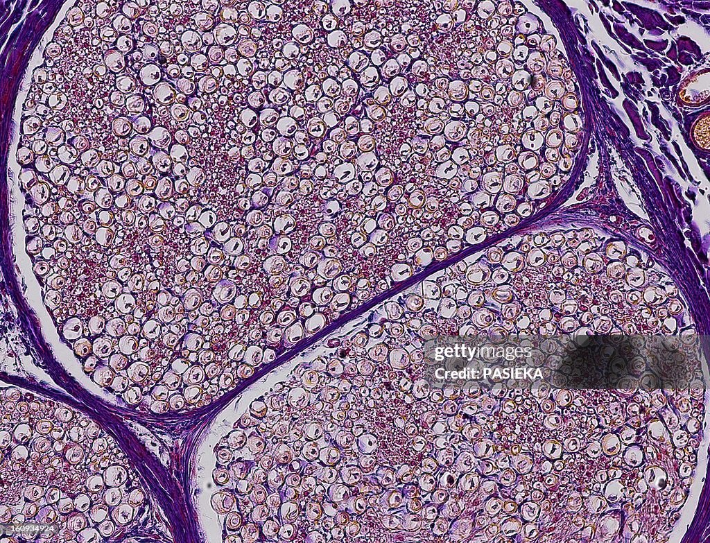 Nerve fibres, light micrograph