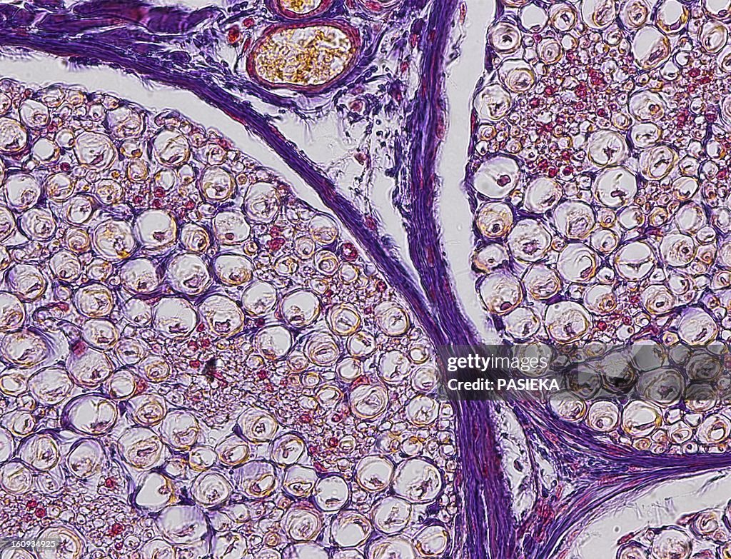 Nerve fibres, light micrograph