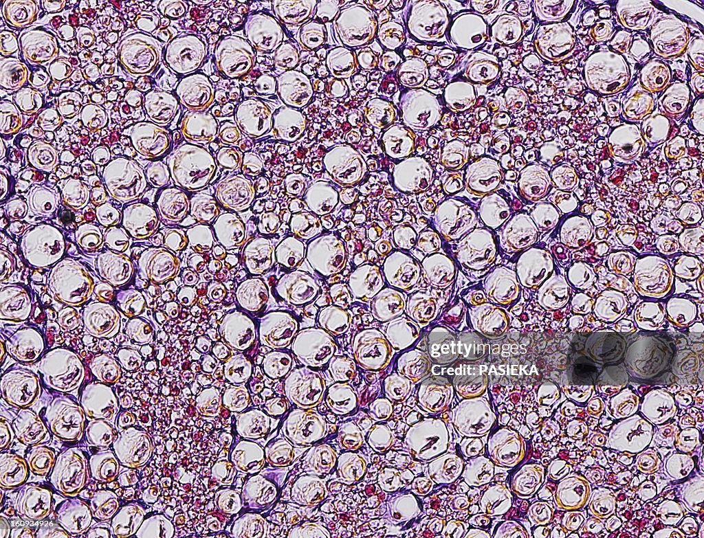 Nerve fibres, light micrograph