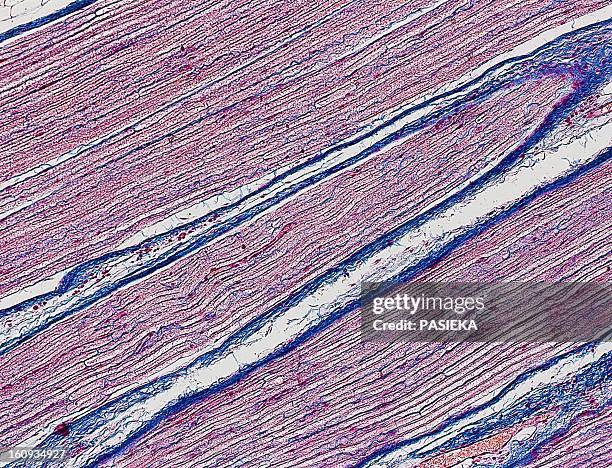 nerve fibres, light micrograph - connective tissue stock pictures, royalty-free photos & images
