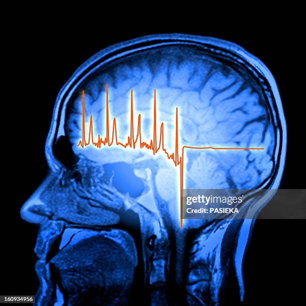 ecg trace and mri brain scan, artwork - eeg brain image stock pictures, royalty-free photos & images