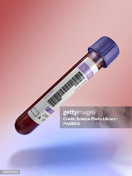 illustrazioni stock, clip art, cartoni animati e icone di tendenza di medical test tube with blood, artwork - test tube