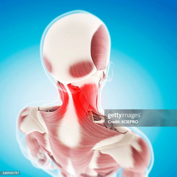 neck pain, conceptual artwork - neck muscle pain illustration stock illustrations