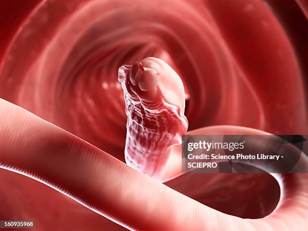 roundworm, artwork - infestation stock illustrations