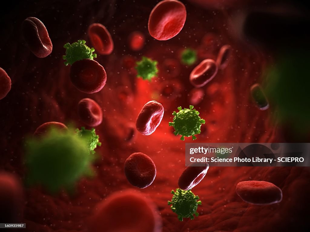 HIV infection, artwork
