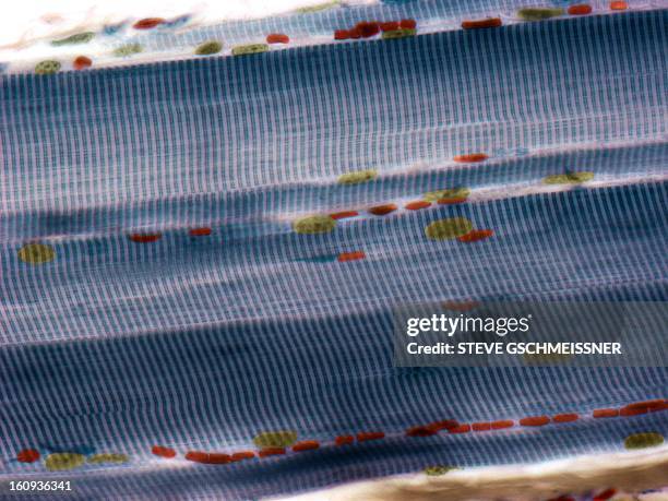 Michrograph 12 Light Micrograph Muscle High Res Illustrations - Getty Images