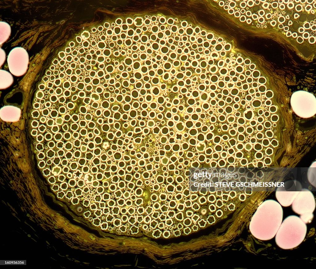 Nerve bundle, light micrograph