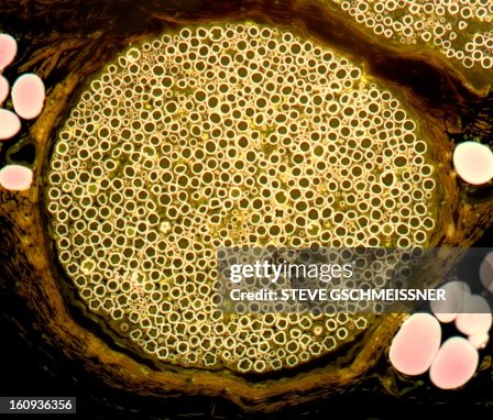 Nerve bundle, light micrograph Nerve bundle, light micrograph