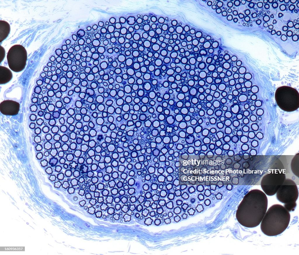 Nerve bundle, light micrograph
