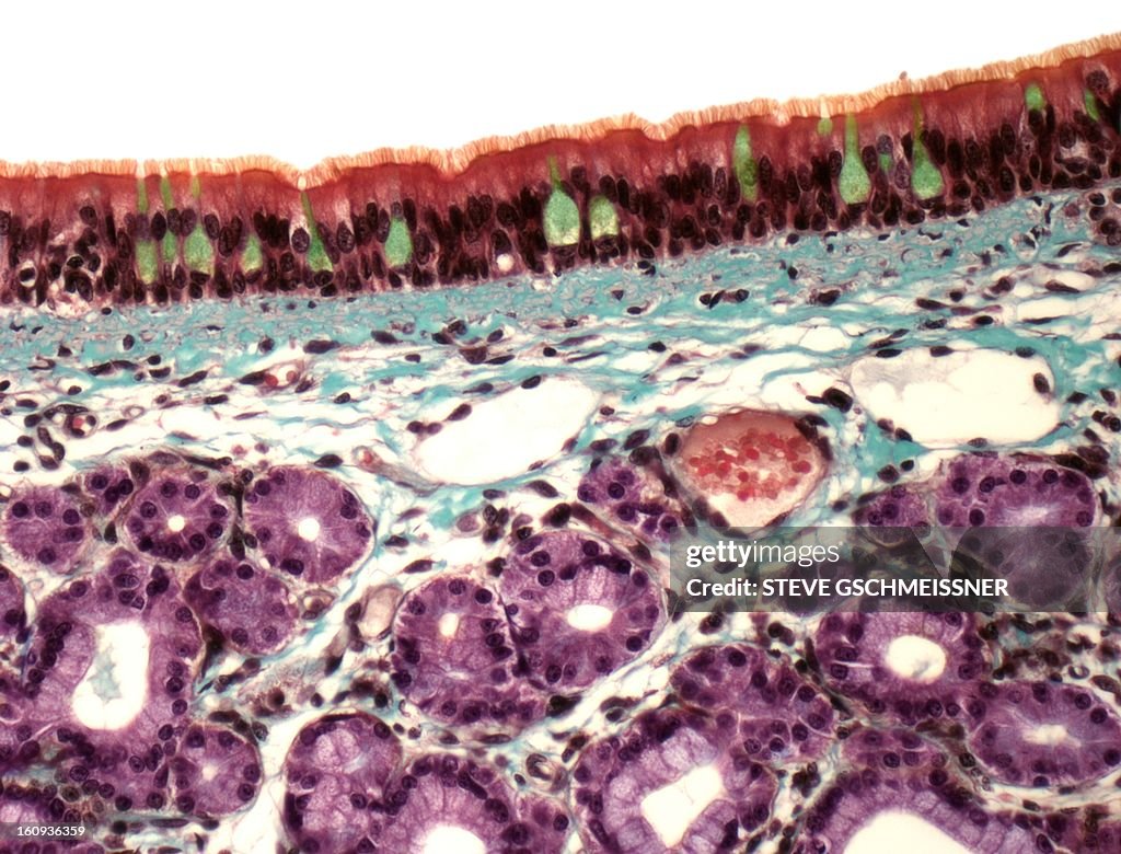 Trachea, light micrograph