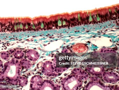Trachea, light micrograph Trachea, light micrograph