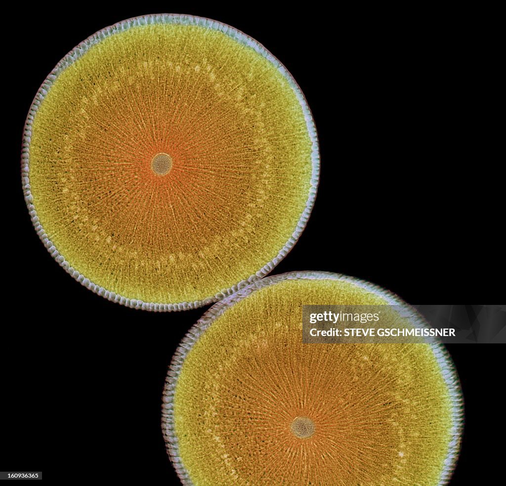 Roundworm ovaries, light micrograph