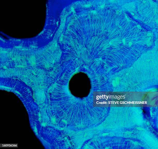 compact bone, light micrograph - haverssches system stock-grafiken, -clipart, -cartoons und -symbole