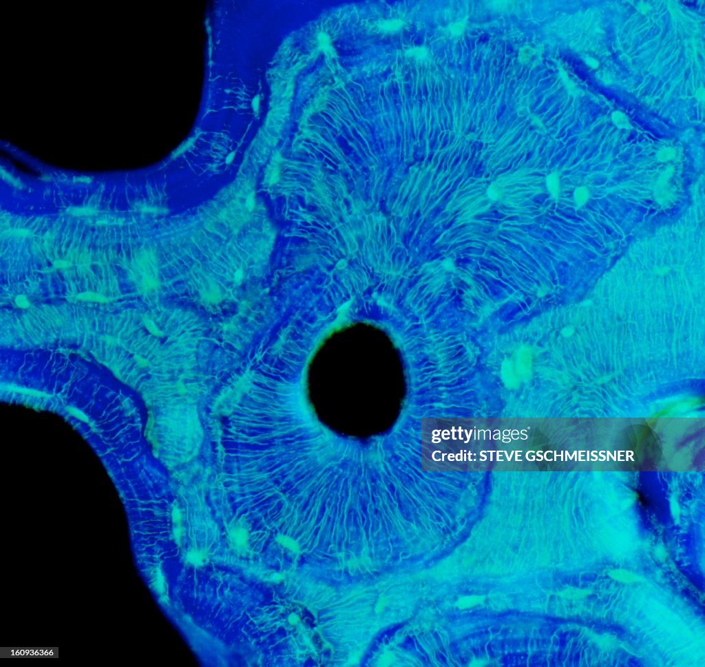 Compact bone, light micrograph