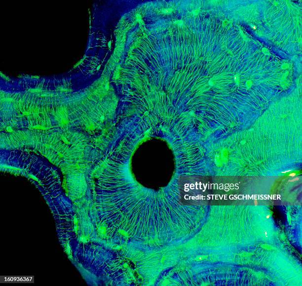 compact bone, light micrograph - haverssches system stock-grafiken, -clipart, -cartoons und -symbole