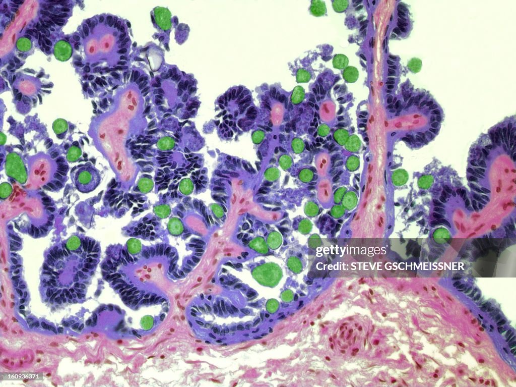 Coccidiosis, light micrograph