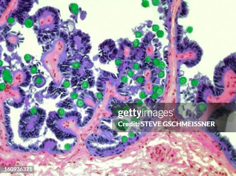 Coccidiosis, light micrograph Coccidiosis, light micrograph