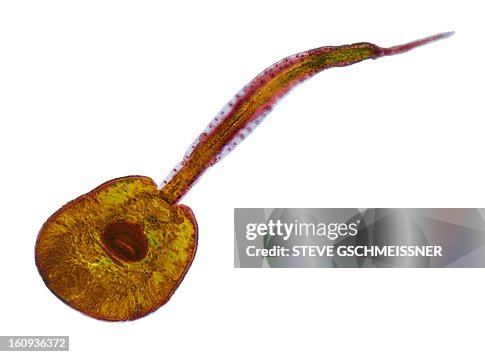 Fluke larva, light micrograph Fluke larva, light micrograph