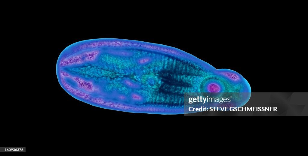 Immature fluke, light micrograph