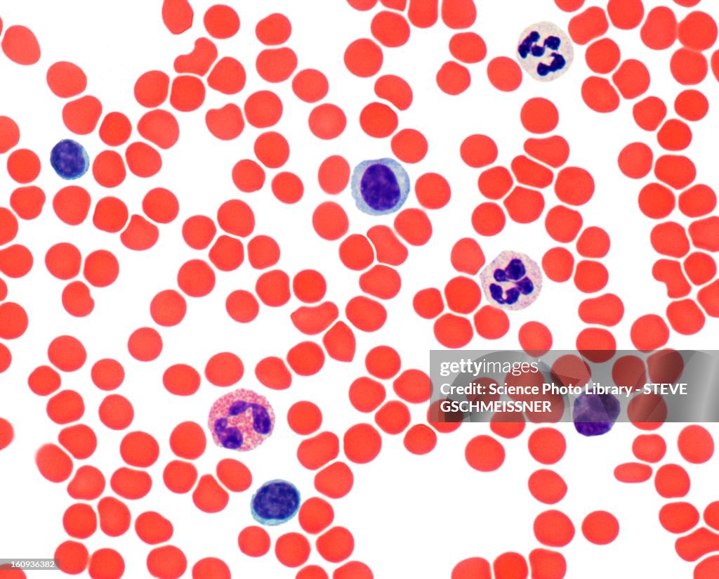 Blood smear, light micrograph